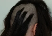 Skrillex ha lanzado, Soma, otro álbum sorpresa
